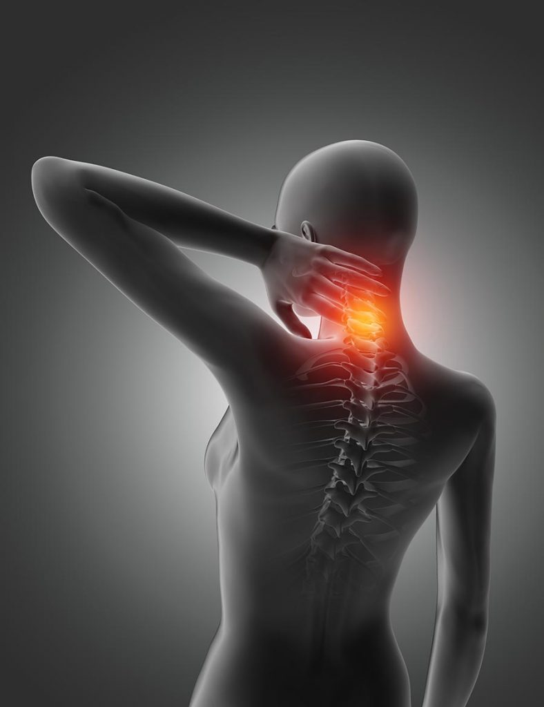 Cervical Pain