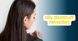 oily dandruff remedies